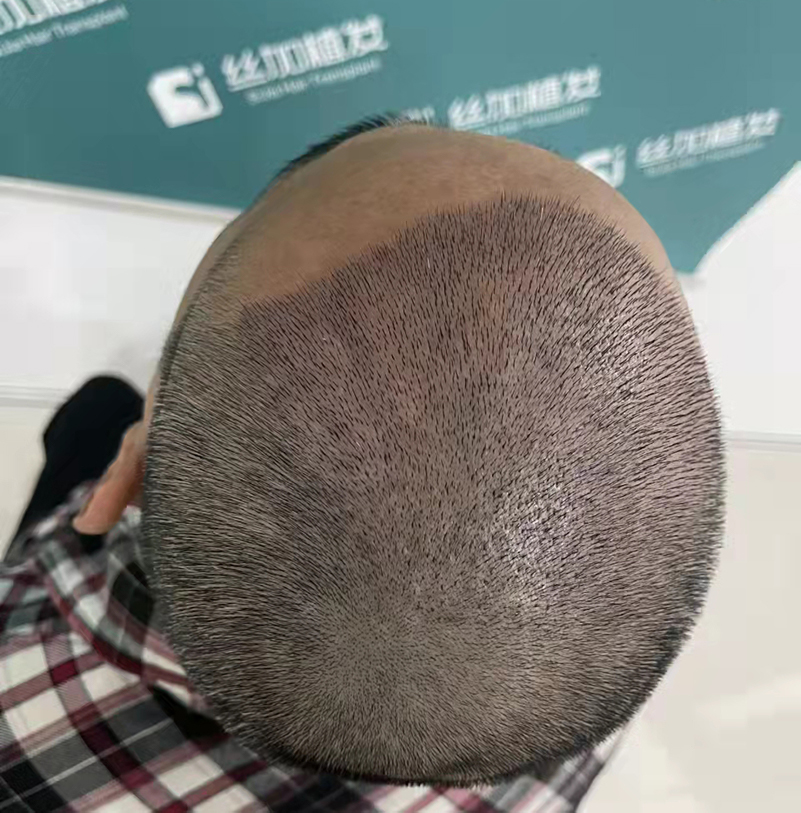 ä¸åŠ æ¤å‘2.jpg