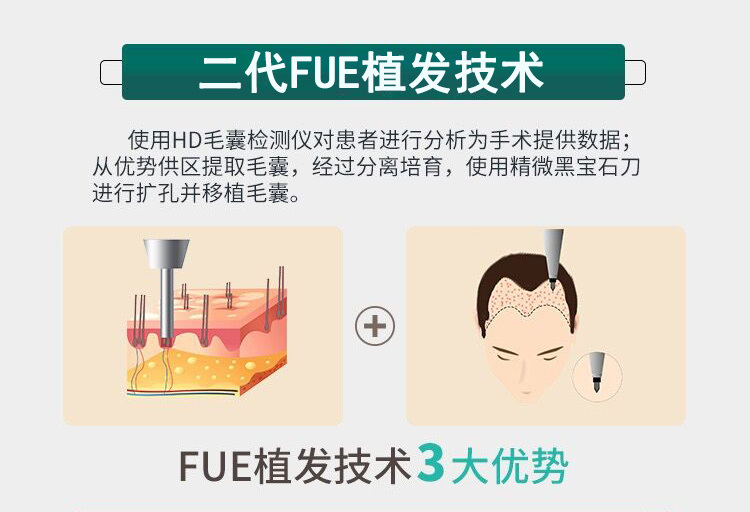 ����FUEֲ�l(f��)���g(sh��)