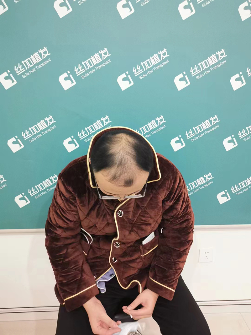 ֲ�l(f��)�ĺ�(ji��n)�ν�B