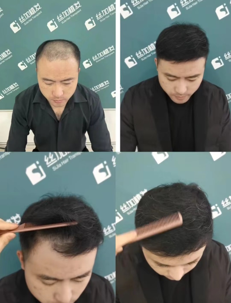 ��ʰ��������׃���󡪡�ֲ�l(f��)�g(sh��)��������(l��i)����